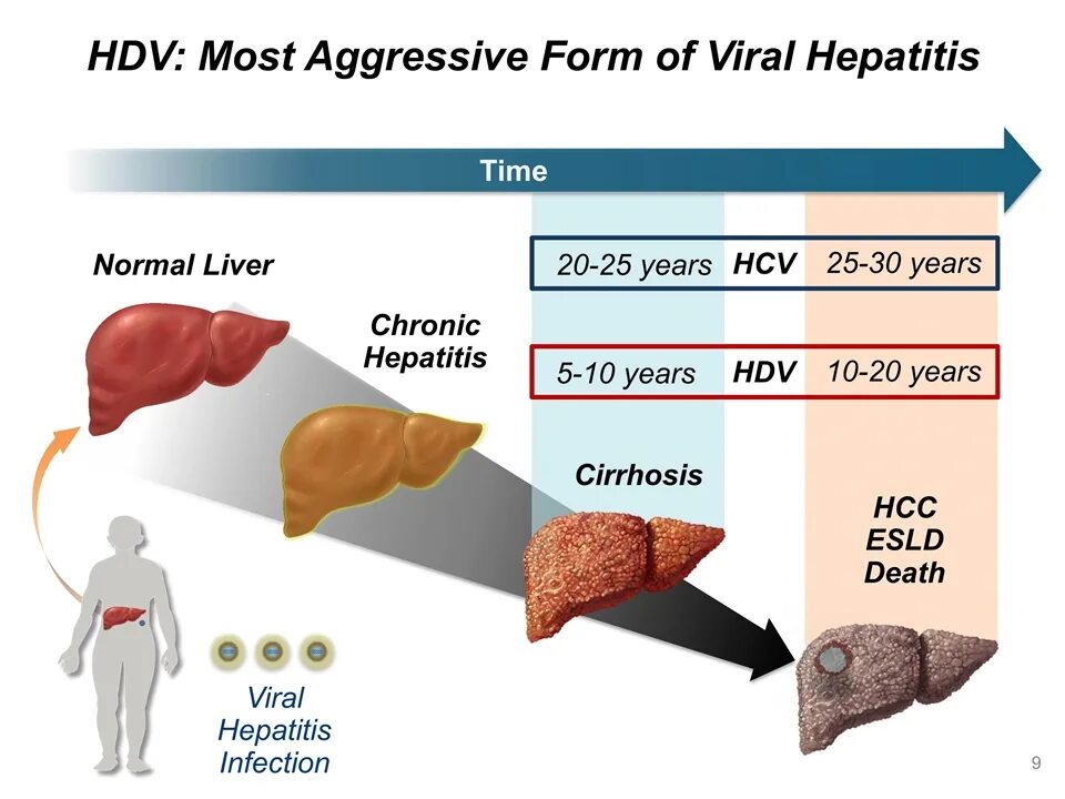 HCV инфекция. Гепатит c.