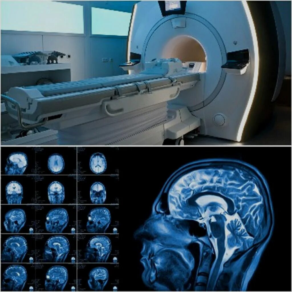 Зачем назначают мрт. Мрт магнитно-резонансная томография головного мозга. Магниторезонансная томография (мрт). Магниторезонансная томография головного мозга.