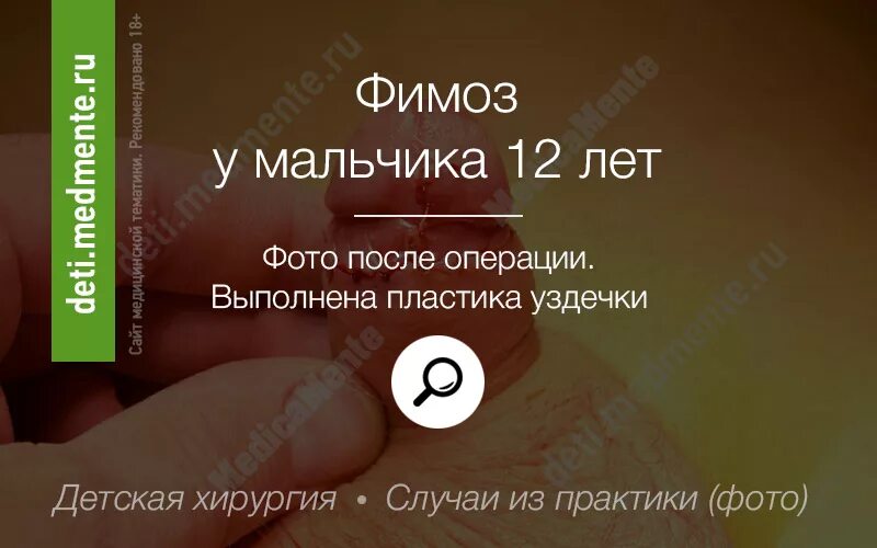 Фимоз у мужчин 18. Фимоз у мужчин 18. Фимоз у мужчин 18. Парафимоз у детей как выглядит. Фимоз у мужчин 18.