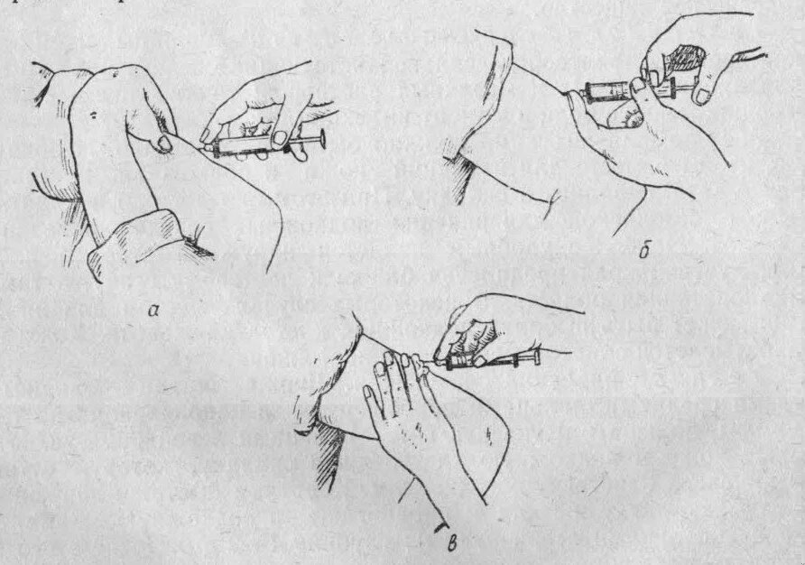 Подкожные инъекции техника выполнения. Подкожно инъекция алгоритм. Алгоритм инъекций внутрикожно. Инъекция подкожно в плечо алгоритм. Подкожное Введение лекарственных средств алгоритм.