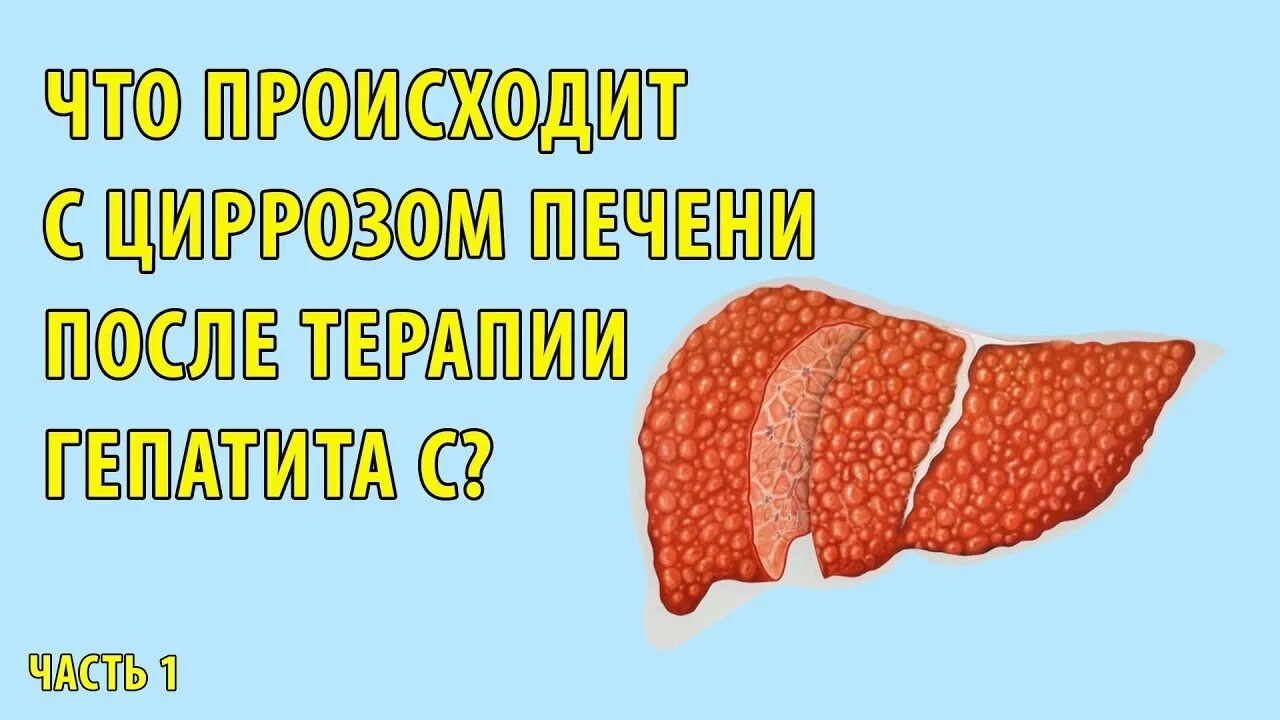 Сколько живут с гепатитом печени