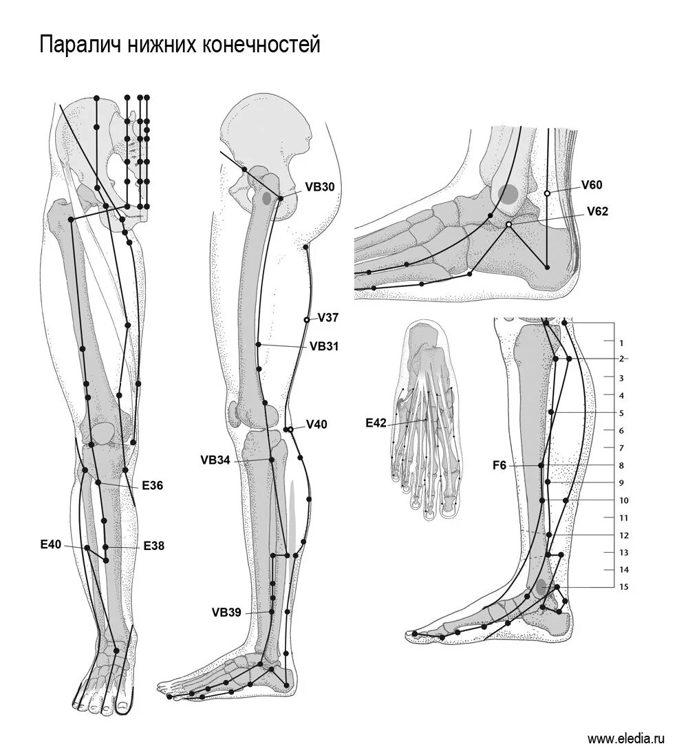 Почему парализует ноги. Акупунктурные точки при парезе нижних конечностей. Vb 30 точка акупунктуры. Эледиа акупунктура прибор. Точки акупунктуры после инсульта.