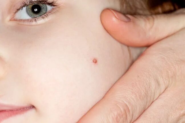 Not so subtle freckles If you are a tattoo artist or permanent makeup artist who