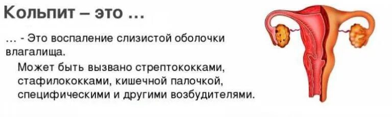 Кольпит при беременности 3 триместр