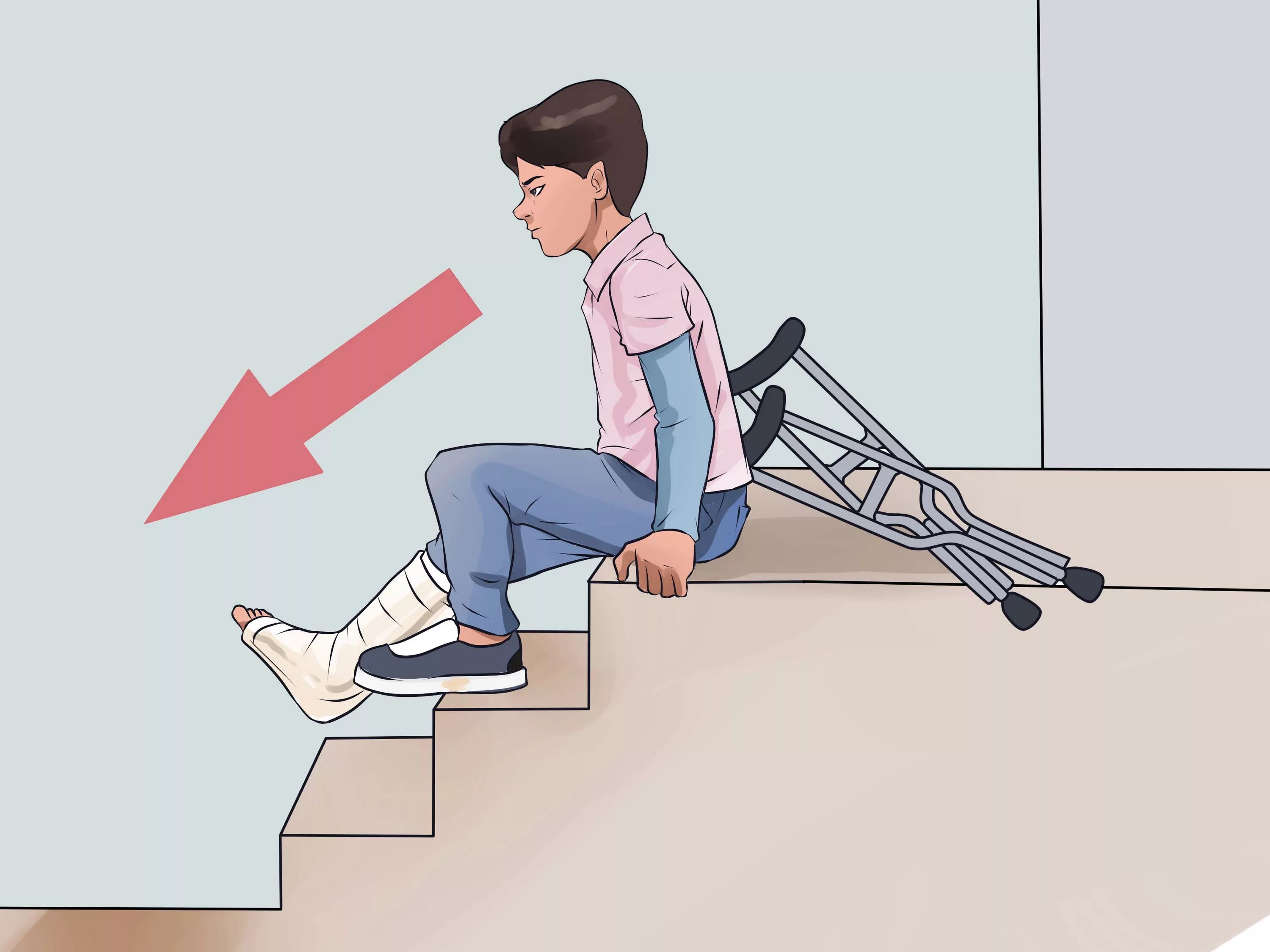 Спуск по лестнице на костылях. Техника хождения на костылях по ступенькам. Ходьба на костылях по лестнице. Упасть на правую ногу