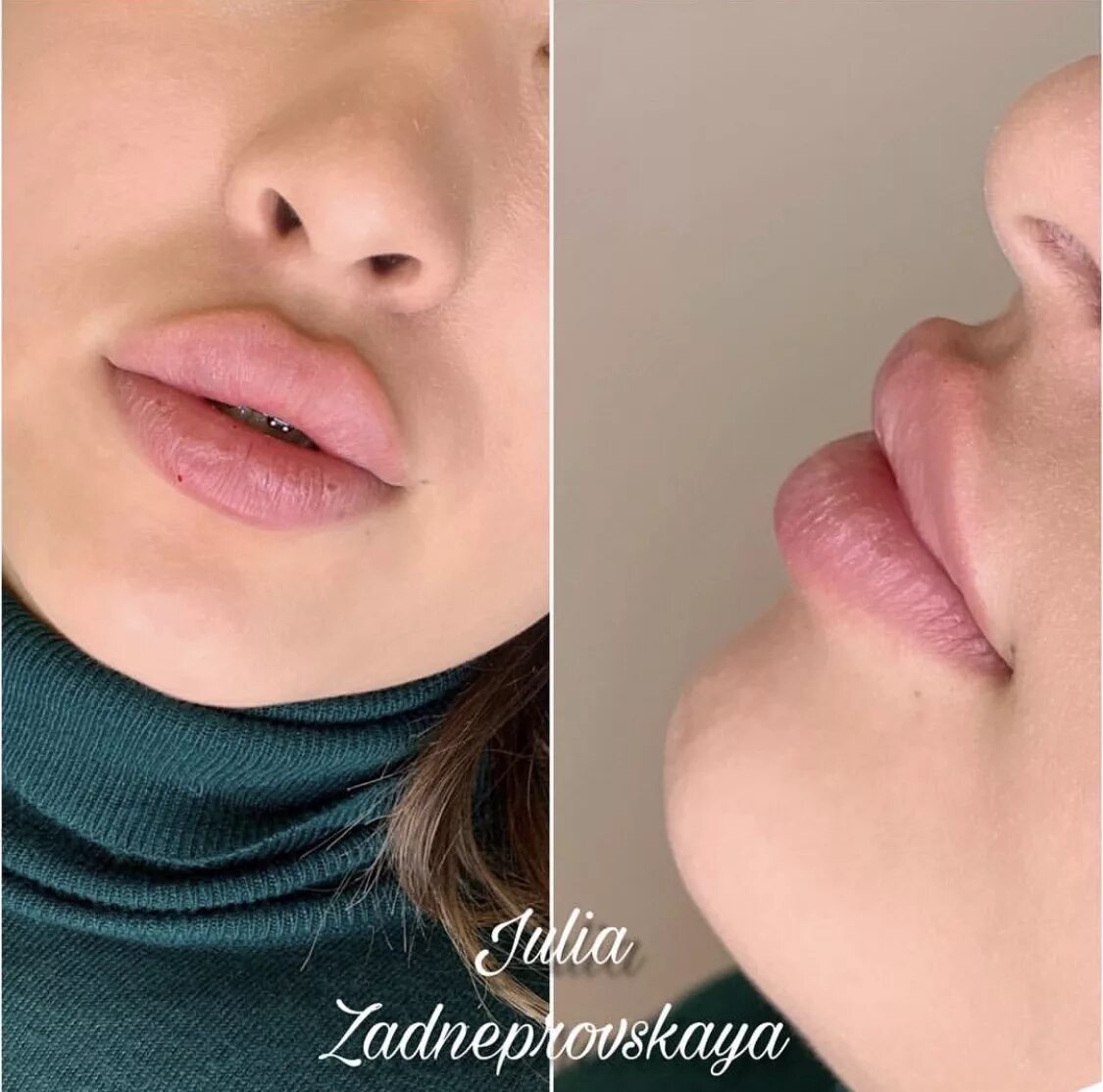 Форма губ бант. Техника увеличения губ бантиком. губы накаченные красивые аккуратные. увеличение губ плоский бантик.