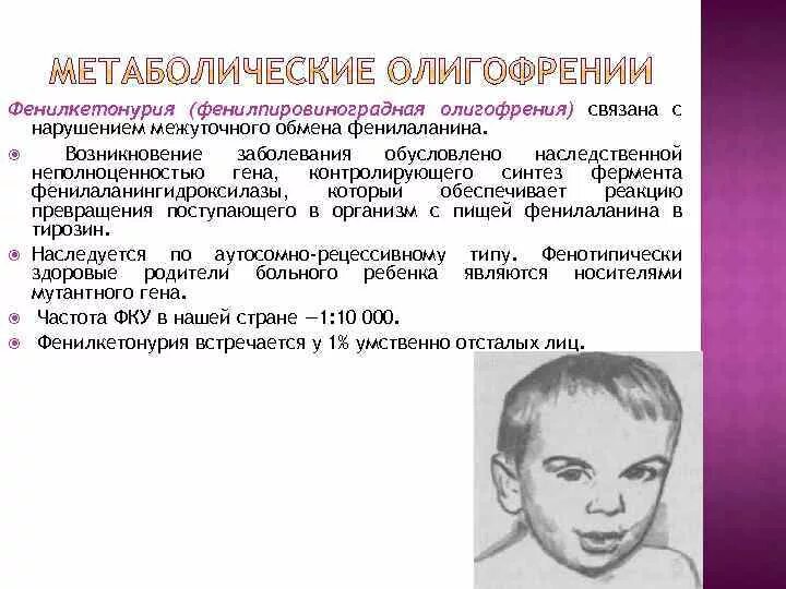 Наследственной умственной отсталости. Фенилкетонурия (фенилпировиноградная олигофрения, синдром Феллинга). Фенилпировиноградная олигофрения симптомы. Синдромы умственной отсталости у детей. Фенилкетонурия наследственное заболевание с нарушением.