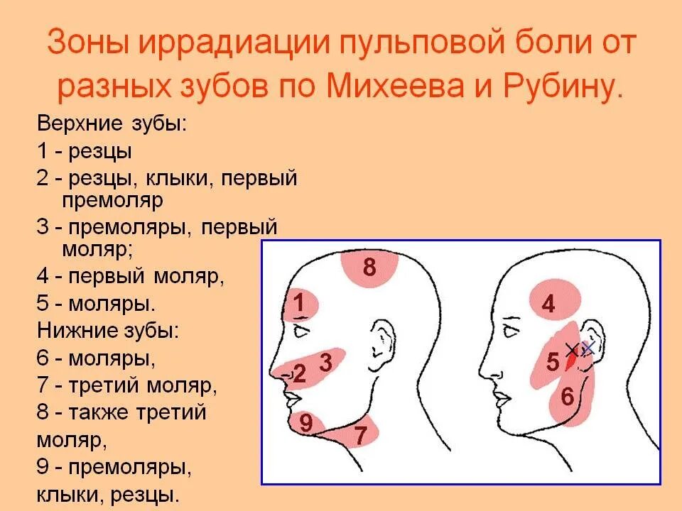 Тянет лоб. Болит верх головы. Зоны иррадиации зубной боли при пульпите. Челюсть отдает в висок.