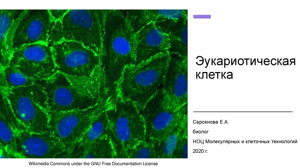 Молекула органического вещества эукариотической клетки. Микроскопия флуоресцентная фиброласты. Флуоресценция микроскопия. Люминесценция микроскопия. Опухолевые клетки люминесцентная микроскопия.