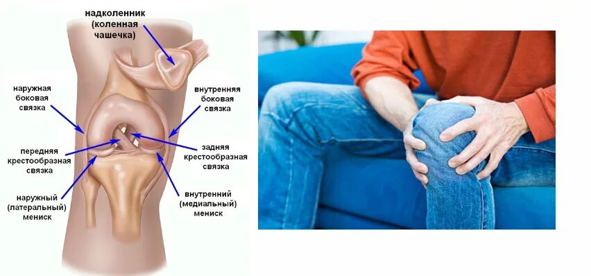 Болит под коленом что это может быть. Боль под коленной чашечкой. Болит под коленной чашкой. Болит колено под чашечкой. Боль под чашечкой в коленном суставе.