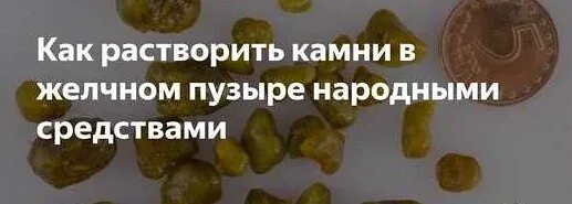 Выходят ли камни из желчного пузыря самостоятельно. Растворить камни в желчном пузыре. средства для растворения камней в желчном пузыре. препараты для растворения камней в желчном пузыре. растворение камней в желчном пузыре.
