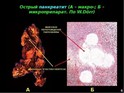 Реактивные изменения паренхимы