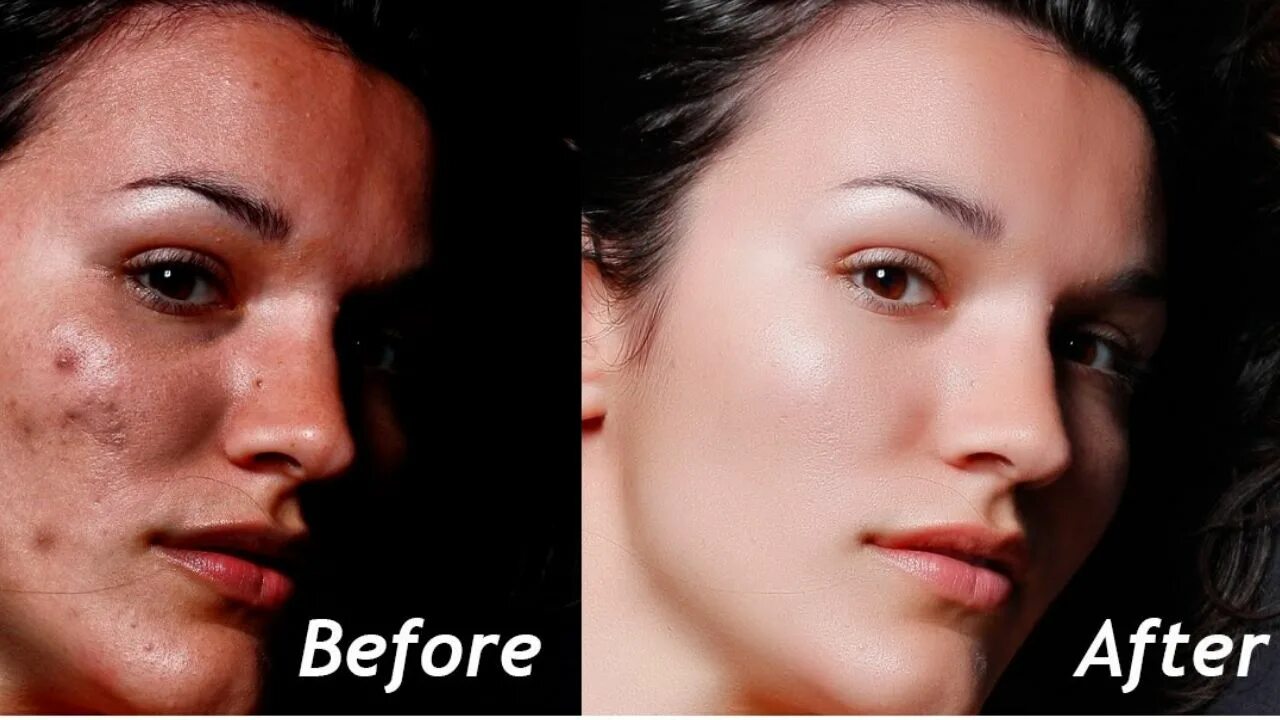 Приложение убирающее дефекты. Фотошоп закрасить выделенную область. Замазки для лица приложение. Лицо девушки с проблемной кожей. Как удалить прыщи в фотошопе.