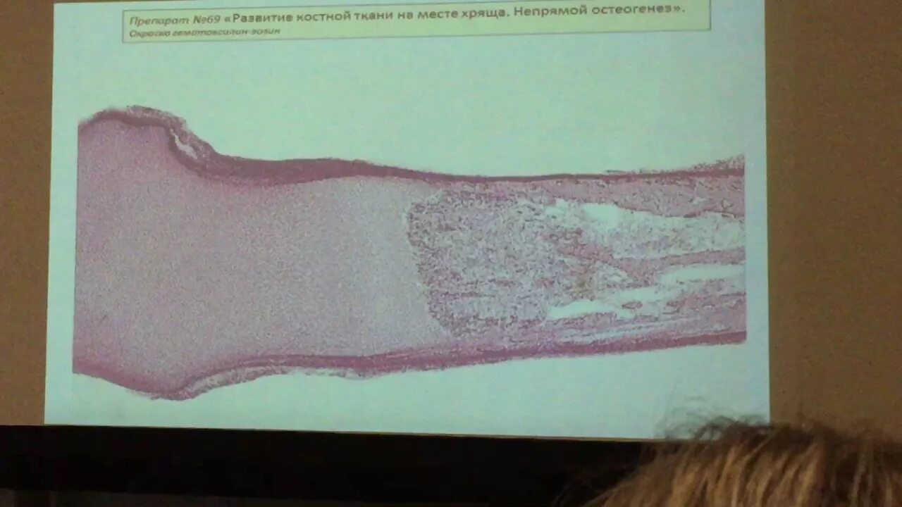 Частная гистология препараты. Препарат по гистология 2 коллоквиум. Препараты 3 коллоквиум гистология. Препарат по гистология 1 коллоквиум. Гистология черт возьми фанфик