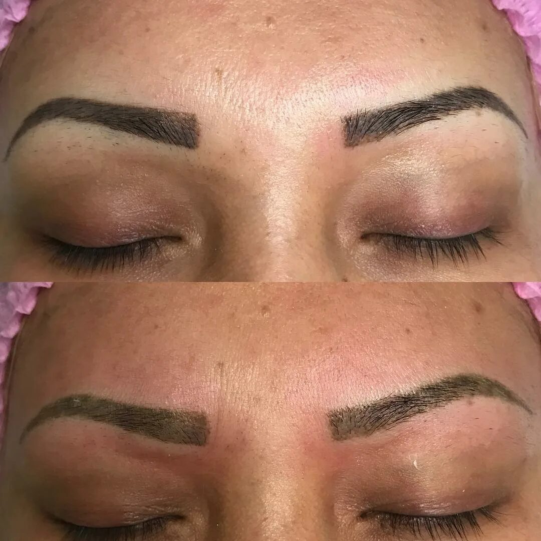 выведение татуажа бровей лазером. цветокоррекция бровей лазером. перманент бровей. как выглядят брови после удаления. брови после ремувера.