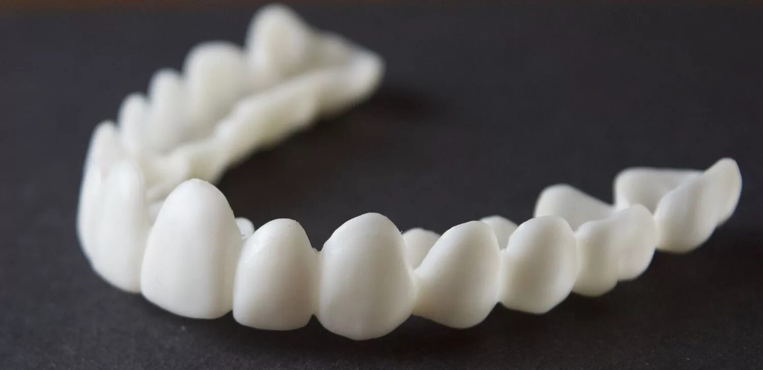 съемные виниры. виниры для зубов snapon smile. виниры почта. виниры почта. виниры почта.