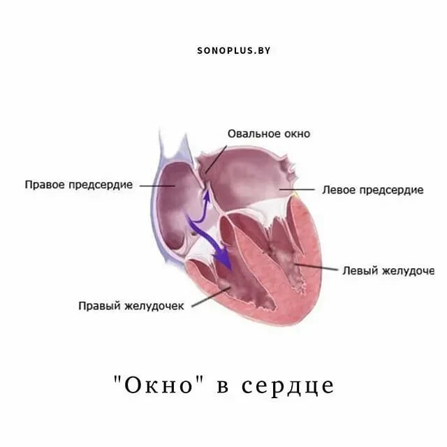 В нормальном открой