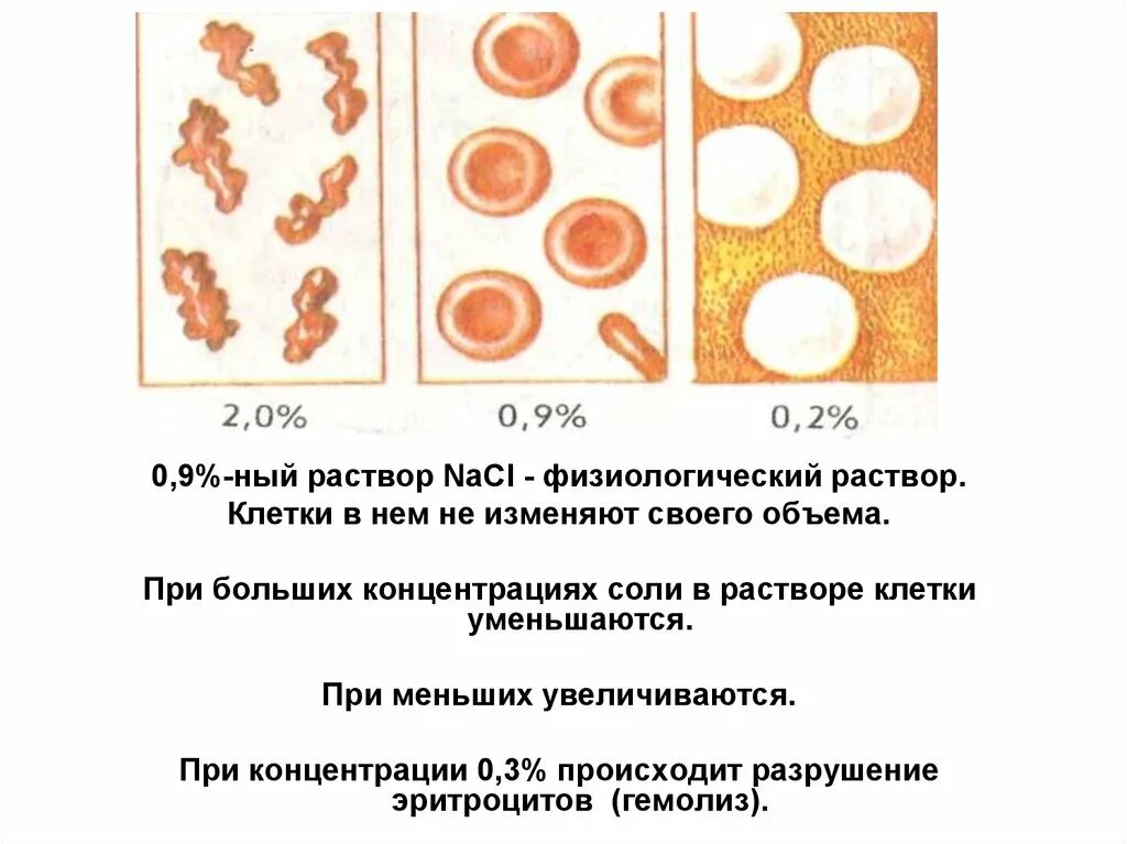 Эритроциты в физиологическом растворе. Клетка в физиологическом растворе. Эритроциты в растворах разной концентрации. Эритроциты в гипотоническом растворе. Эритроциты в растворе хлорида натрия