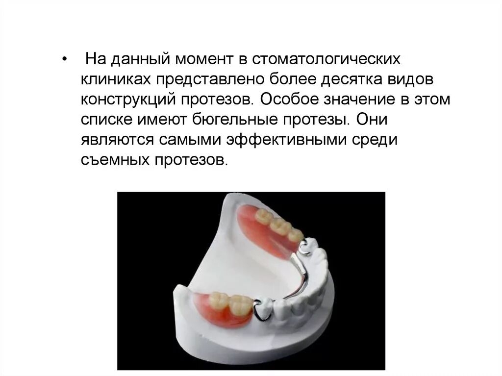 Этапы изготовления бюгельного протеза. Клинико лабораторные этапы изготовления бюгельного. Клинико лабораторные этапы изготовления бюгельных протезов. Критерии качества бюгельного протеза.