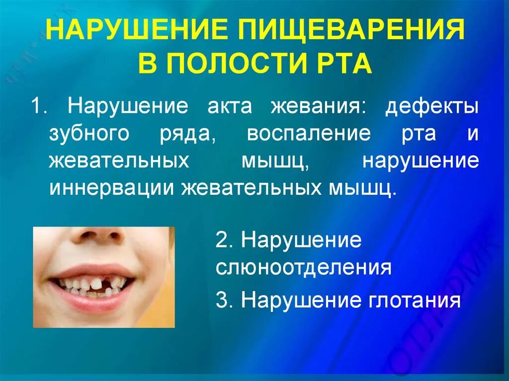 Нарушение пищеварения в полости рта. Расстройства пищеварения в ротовой полости. Причины нарушения пищеварения в полости рта. Нарушение пищеварения в полости рта патофизиология.