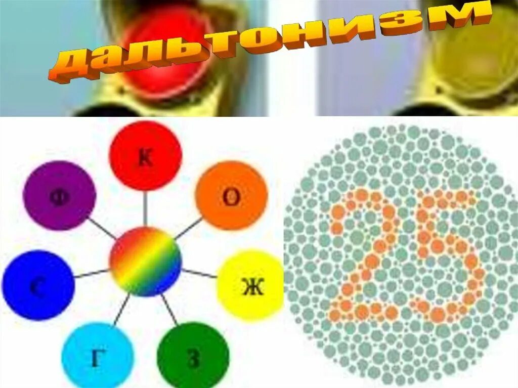 Дальтонизм. Дальтонизм наследственное заболевание. Дальтонизм генетика. Дальтонизм биология. Метод наследования дальтонизма