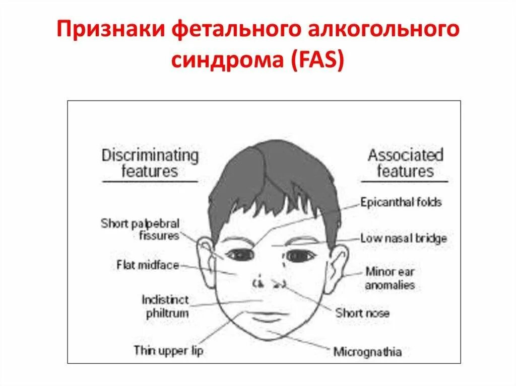 Фетально алкогольный