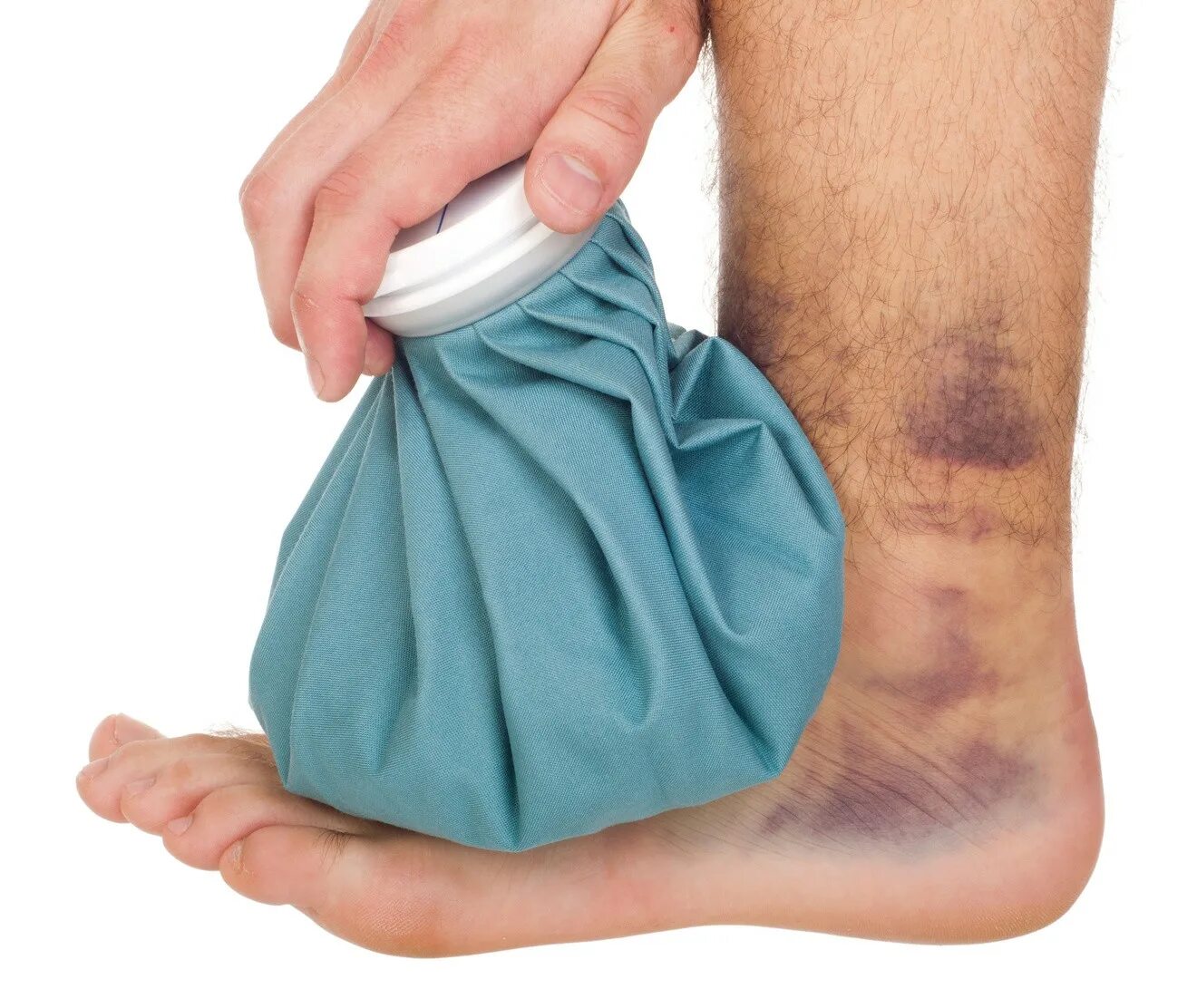 охлаждающий компресс. холодный компресс на ногу. холодовой компресс. что приложить к ушибу на ноге. гигрома голеностопного сустава.