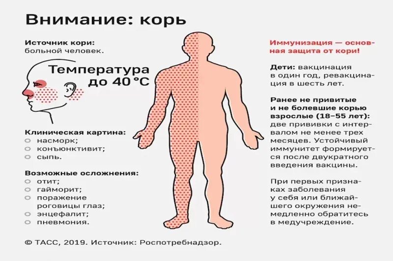 Через сколько можно заболеть корью