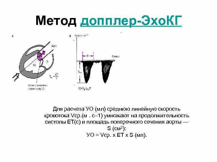 Площадь поперечного сечения аорты. Площадь поперечного сечения в эхокг. ударный объем эхокг. площадь сечения аорты. ударный объем эхокг формула.