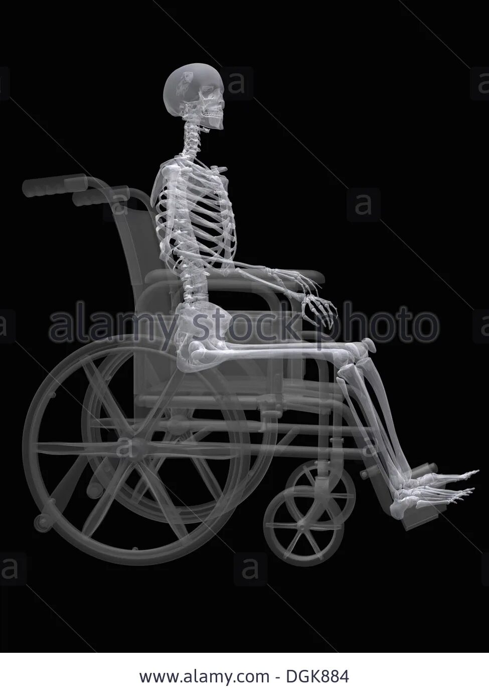 Скелет сидит. Skeleton in wheelchair. Hurt himself