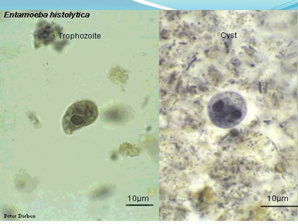 Entamoeba histolytica. Entamoeba histolytica циста. Entamoeba histolytica под микроскопом. Цисты Entamoeba. Entamoeba coli в кале
