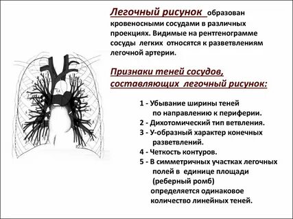 Диагноз усиление