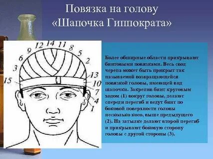 Повязка гиппократа
