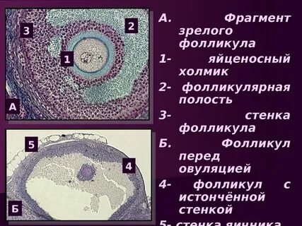 Стенка фолликула