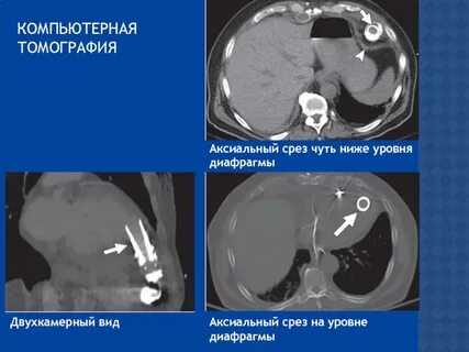 Кт количество срезов