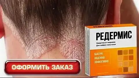 Укол эфлейра отзывы