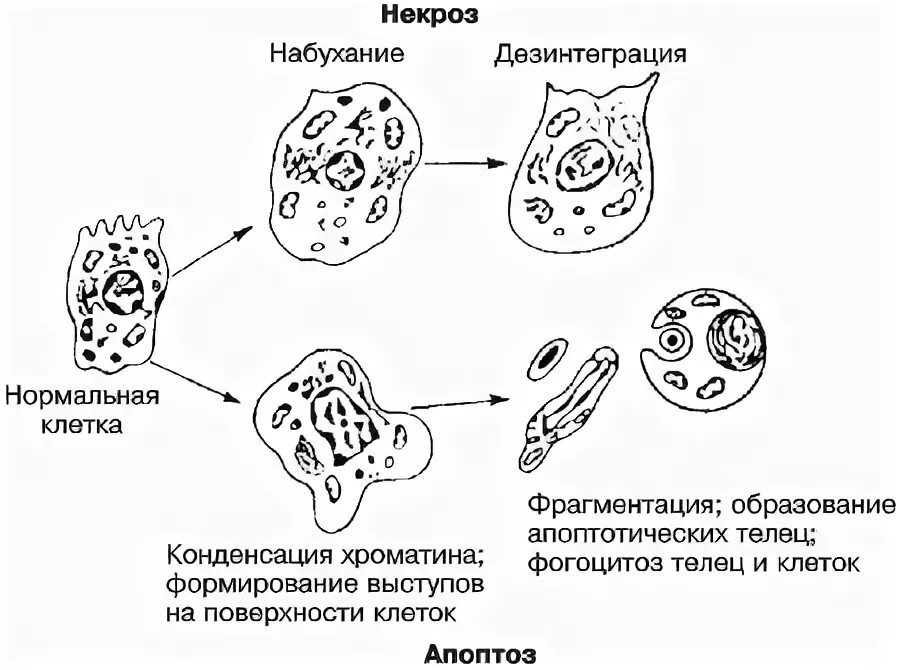 Некроз клетки схема. Схема стадий некроза и апоптоза. Схема форм гибели ядра клетки. Апоптоз и некроз схема. Морфологическая дезинтеграция