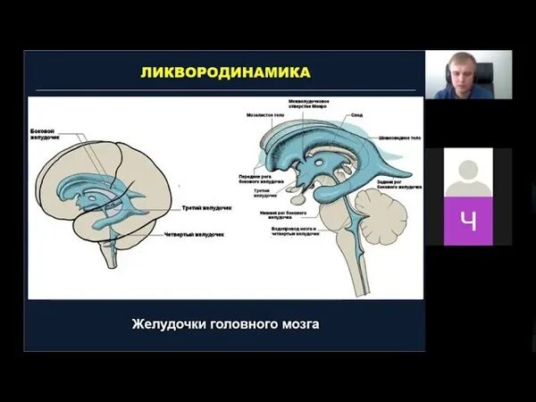 Система оттока ликвора из головного мозга. Ликвородинамика желудочки головного мозга. Ликворная система головного мозга схема. Нейрохирургия головного мозга. Ликворные изменения мозга