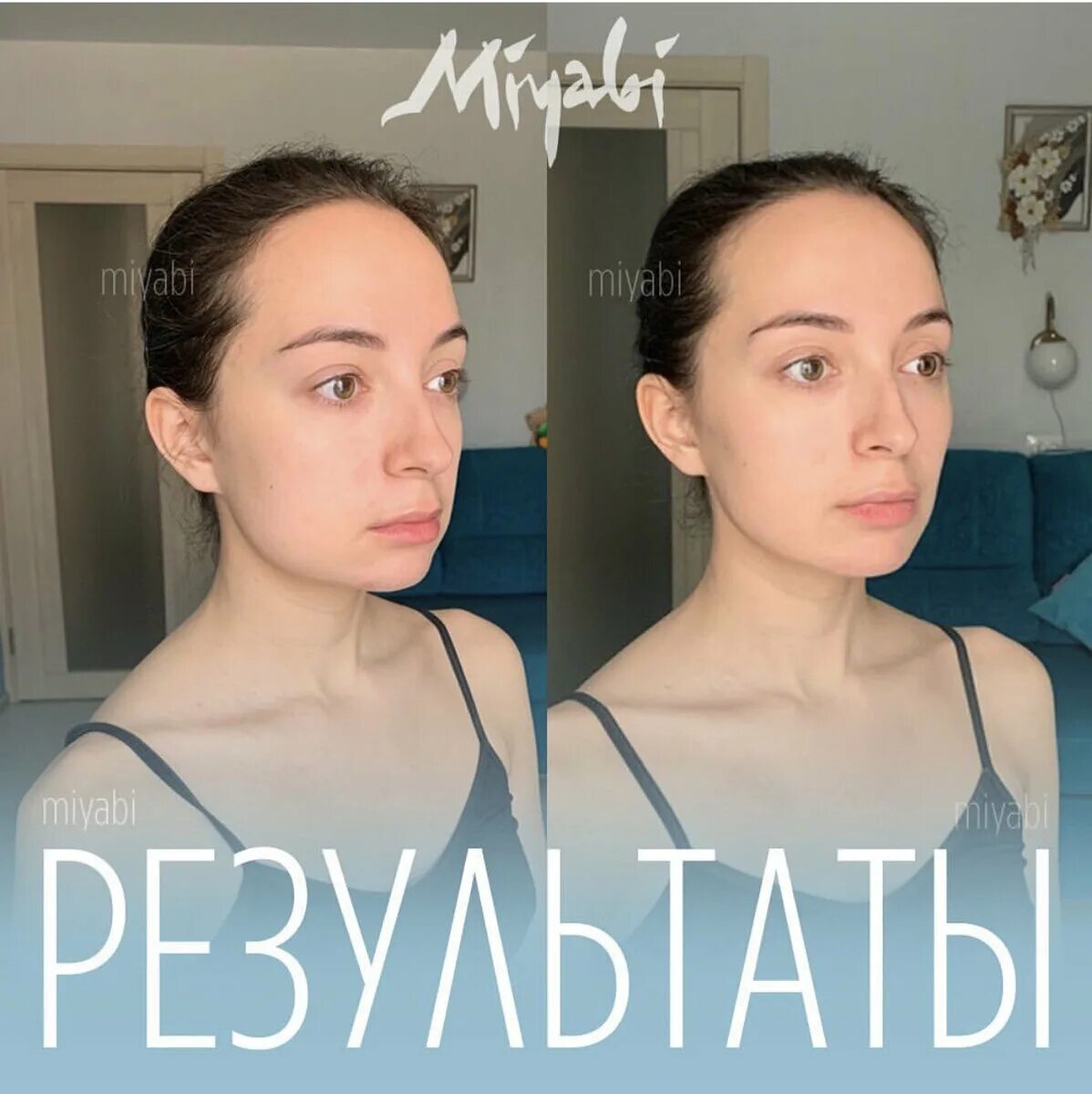 Как исправить асимметрию лица. Как исправить асимметрию лица