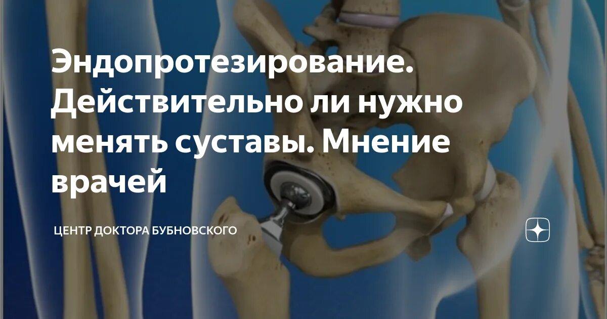 Ростов замена коленного сустава. Протез коленного сустава. Эндопротезирование суставов. Эндопротезирование коленного сустава реабилитация. Эндопротезирование тазобедренного сустава.