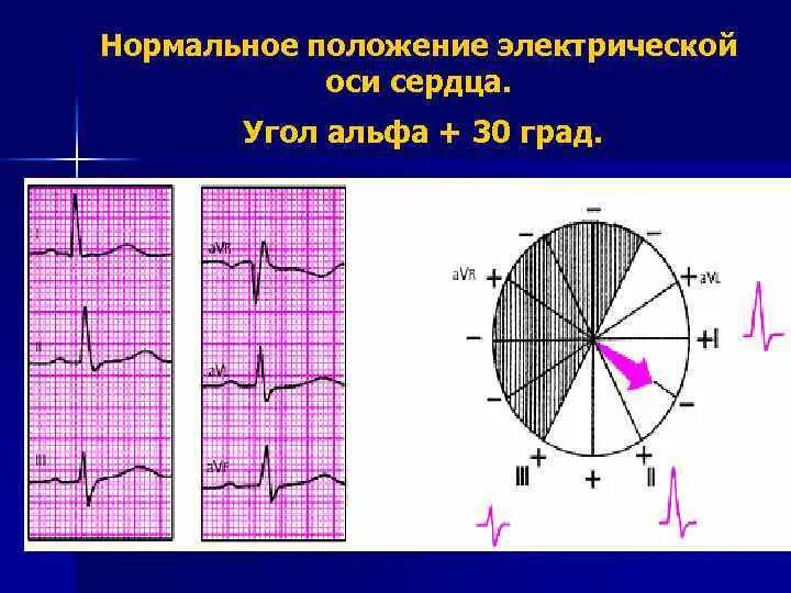 При нормальном положении эос угол альфа. При нормальном положении эос угол альфа
