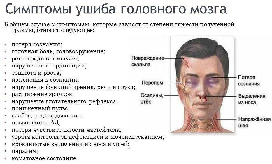 Основной признак сотрясения головного мозга. Диагностические критерии сотрясения головного мозга. Критерии ушиба головного мозга. Признаками сотрясения головного мозга являются:. Ноющая боль в лице