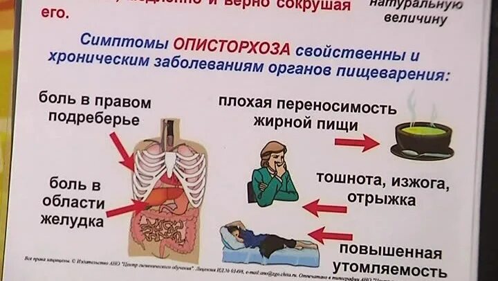 Описторхоз симптомы у взрослых. Описторхоз клиника. меры профилактики описторхоза. профилактика описторхоза у человека.