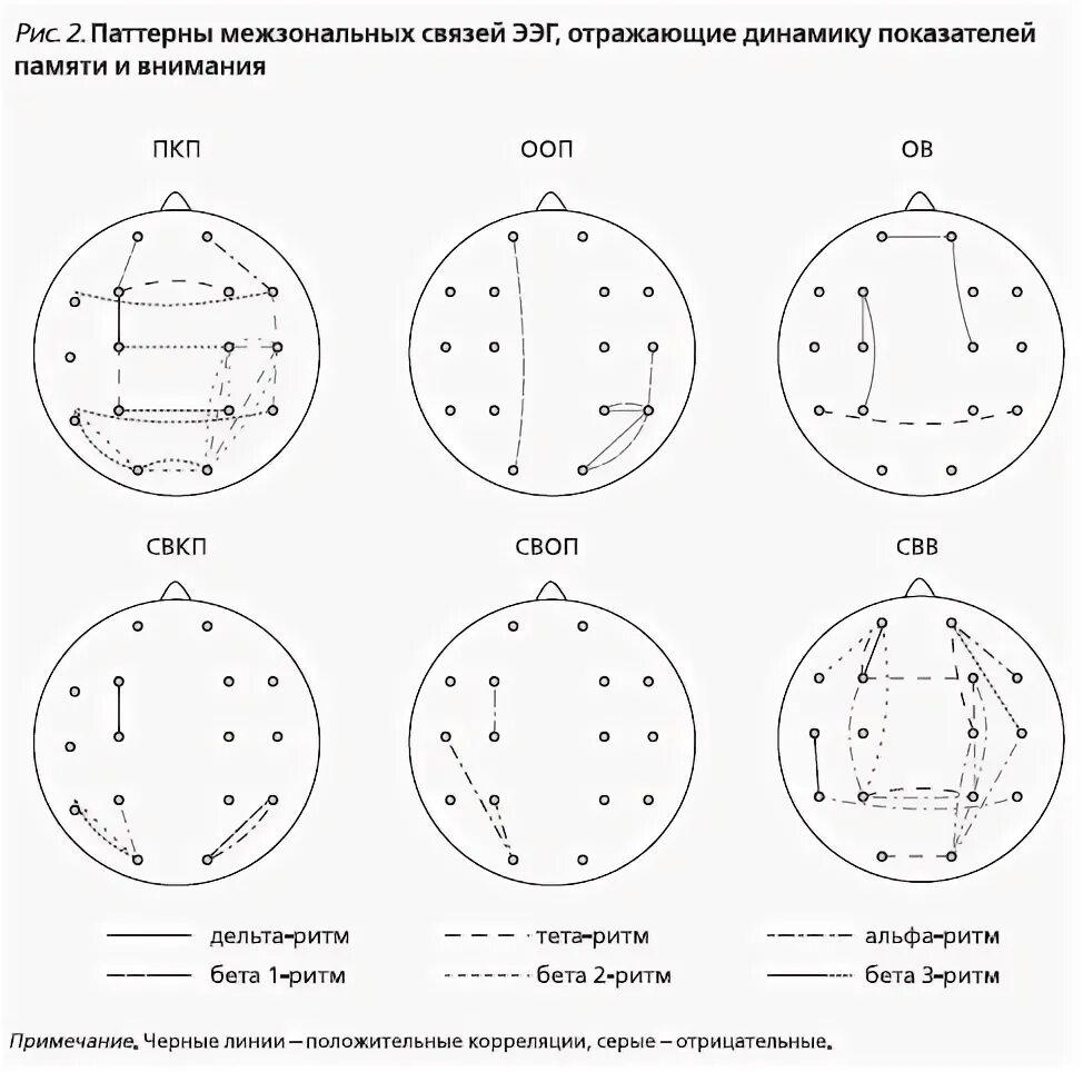 Паттерны ээг. Расположение электродов ээг. ээг корреляты внимания. ээг индикаторы внимания. исследование межзональных связей в ээг.