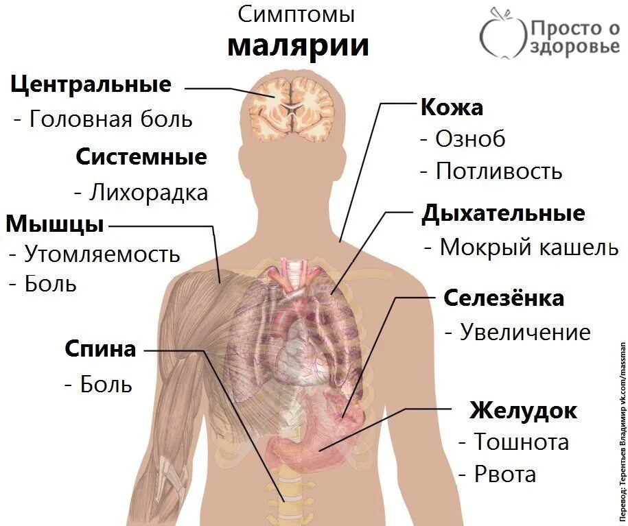 Малярийный плазмодий заболевание. Малярийный плазмодий клинические проявления. Симптомы заражения малярией. Малярийный плазмодий признаки заболевания.