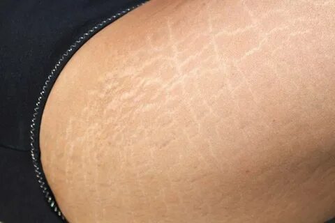 Прилегает к коже и