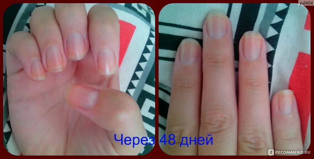 Как отрастить ногти за месяц. Ногти за месяц. ногти за месяц до и после. ногти отрасли за месяц. ногти до и после отращивания.
