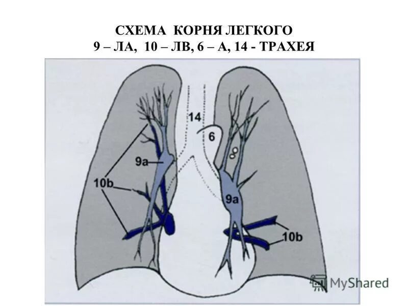 Элементы корня легкого