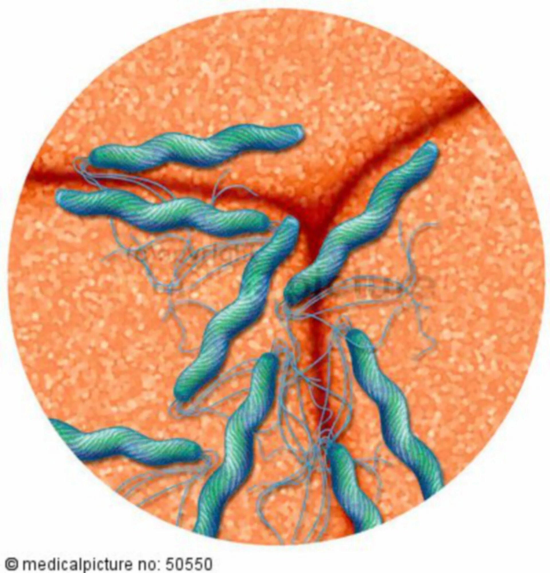 Хеликобактер пилори на коже. Хеликобактер пилори в желудке. Helicobacter pylori симптомы на коже. Перхоть хеликобактер пилори. Причины заболевания хеликобактером