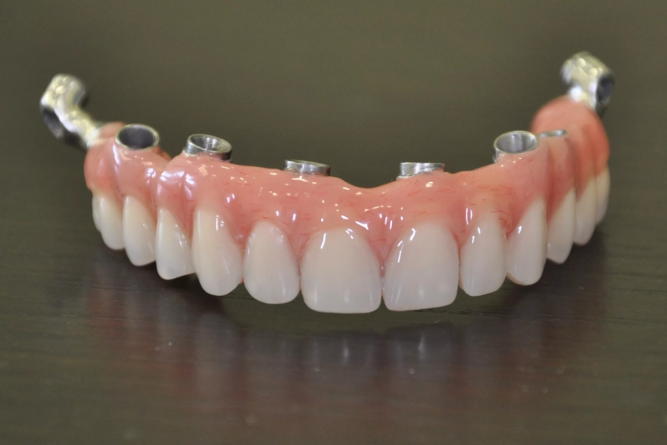Зубные протезы нового поколения цена. Зубные протезы нового поколения. Акриловые зубные протезы на имплантах.